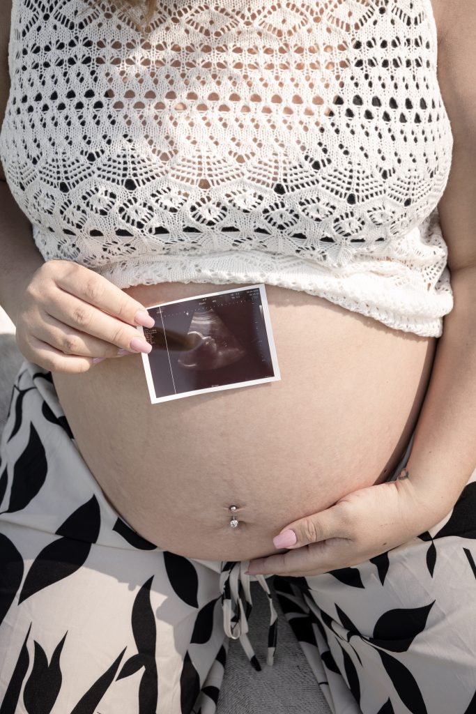 Werdende Mutter hält bei einem Babybauch-Shooting ein Ultraschallbild auf ihren Schwangerschaftsbauch.